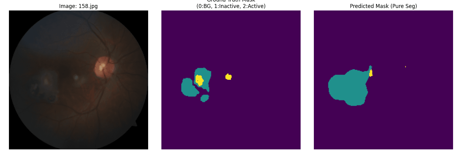 EyeCLIP-Segmentation